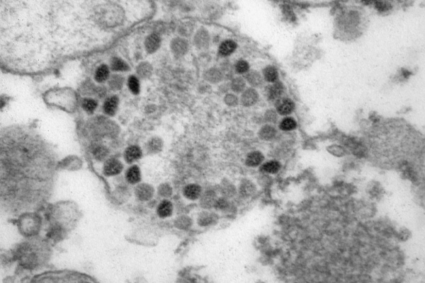   Роспотребнадзор опубликовал фотографии зараженных "омикроном" клеток 